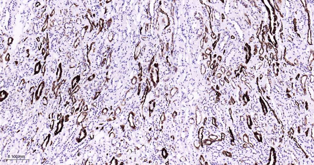 人Keratin 7即用型免疫组化试剂盒-IHC0604H
